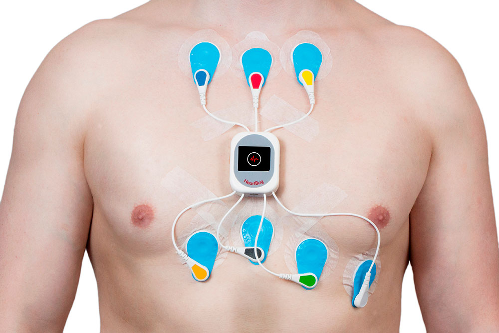 Holter ECG para detectar arritmias, taquicardias - Cardiavant
